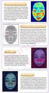 Analyseur de peau faciale 3D <span class=keywords><strong>Prix</strong></span> 2025 Analyse de peau professionnelle Ai Scalp Korea Device Portable High Tech Skin Tone Detector - Product Image 5