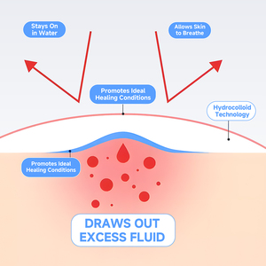 Cerotti Idrocolloidali per Brufoli e Imperfezioni da 36 Pezzi, Idratanti e Antirughe, Prodotti di Bellezza per la Cura della <span class=keywords><strong>Pelle</strong></span> per Tutti i Tipi di <span class=keywords><strong>Pelle</strong></span> - Product Image 4