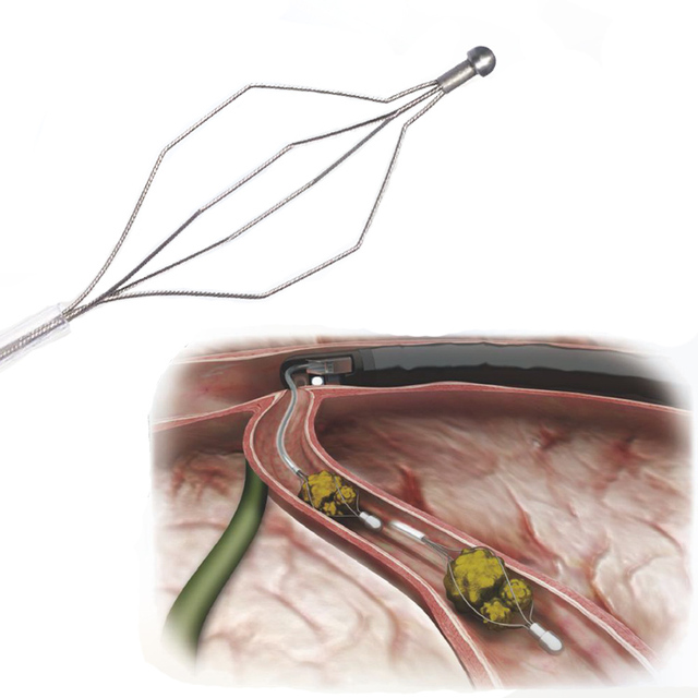 Biliary Duct Gallstone Extraction Basket Upper and Lower Digestive Tract Disposable Endoscope Stone Extraction Basket ERCP