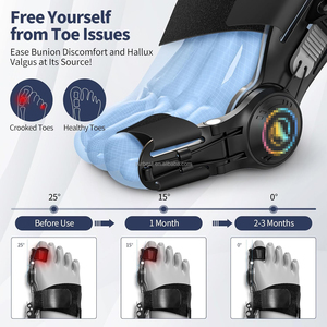 Ortopedi Adjustable Knob pelurus jari kaki korektor Bunion dan dukungan sendi penjepit untuk kaki besar Hallux Valgus bantuan - Product Image 6