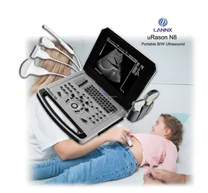 Lannx urason n8 echography מכונת אולטרסאונד ניידת סורק כלי דם ציוד בדיקה אולטרסונידו