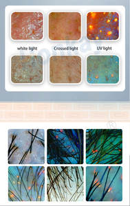 Escáner de Piel Portátil, Detecta Arrugas, Poros, Pigmentación, Humedad, Análisis de Piel con Luz UV, para Salón y Spa - Product Image 5