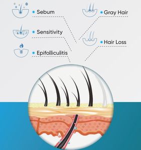 Meicet M-18S Micro-caméra Analyseur de peau et de cheveux Machine de test pour les soins de la peau <span class=keywords><strong>Microscope</strong></span> Wifi Intelligent pour le cuir chevelu - Product Image 2