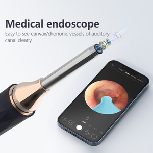 Wireless Wifi Electric <b>Ear</b> Pick Tool Earwax Removal Kit 1080P <b>Ear</b> Cleaner Otoscope With <b>Camera</b> Light <b>Ear</b> Wax Removal - Product Image 3