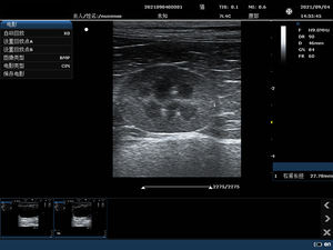 Máquina de Ultrassom Doppler Colorido C10B Dispositivo Portátil - Product Image 5