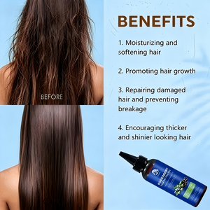 Suero Vegano Nutritivo para el Cuidado del Cuero Cabelludo, Contra la Caída del Cabello, Venta al Por Mayor, Fabricante, Fórmula Personalizada, Marca Privada, <span class=keywords><strong>Aceite</strong></span> Capilar de Romero - Product Image 5