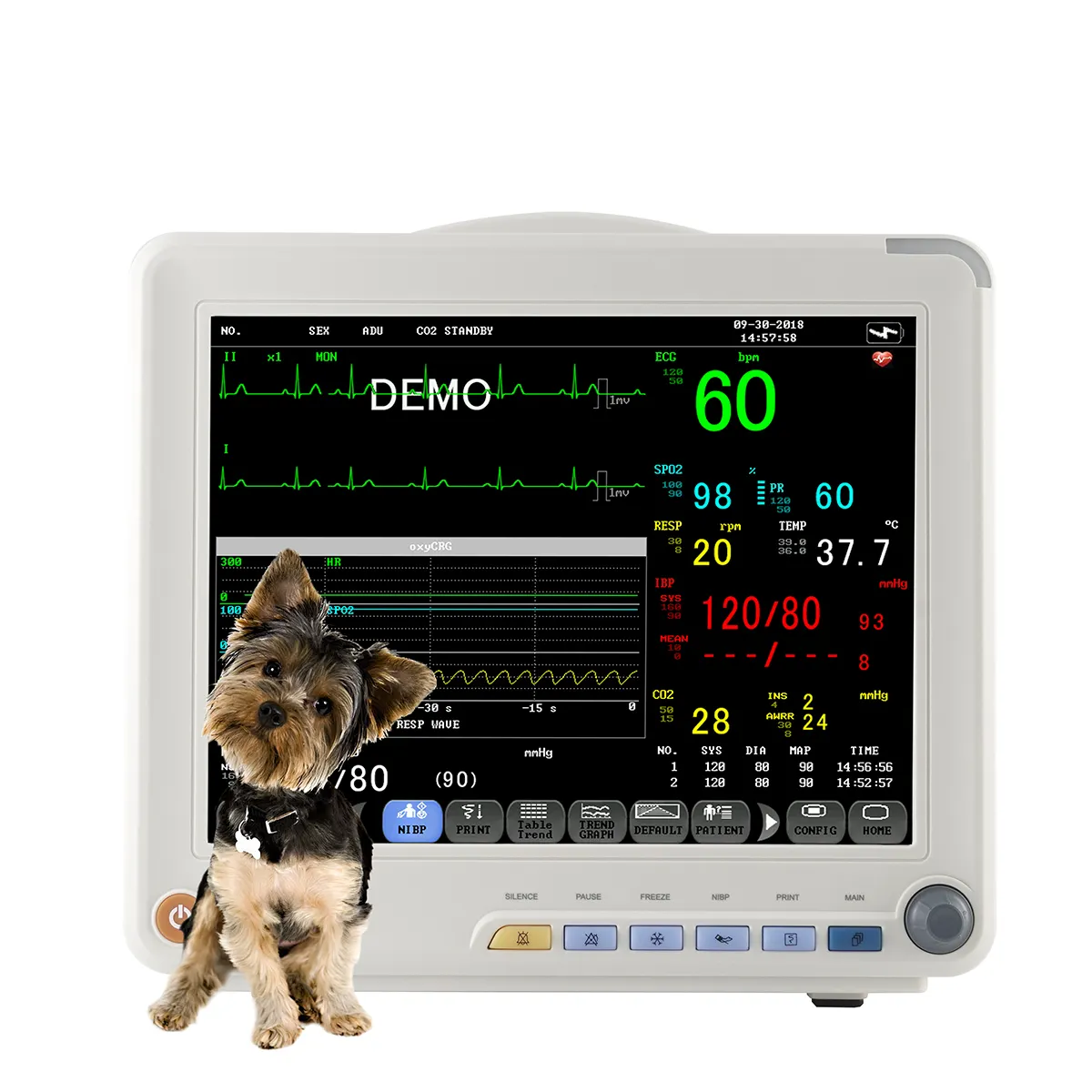 Medical Vital Signs Monitor Multi Parameter Monitor Veterinary ICU Portable 12.1 Inch Touch Screen Monitor MSLMP57
