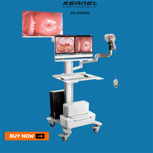 गर्भाशय ग्रीवा, वल्वा और योनि ऊतकों की नैदानिक परीक्षा के लिए प्रबंधन सॉफ्टवेयर के साथ कर्नेल डिजिटल वीडियो कोपोस्कोप - Product Image 2