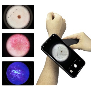 Iboolo y tế kỹ thuật số xách tay dermatoscope de-4100 Pro polaried & 365nm chế độ UV - Product Image 2