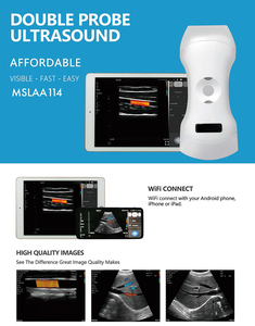 192 Element Phased Array cardiaco, lineare e convesso 3 in 1 Scanner ad ultrasuoni Color Doppler portatile - Product Image 4