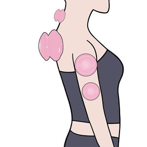 Set Terapi Bekam Silikon, Cangkir Pijat Profesional Tiongkok untuk Terapi Bekam dan Pengurangan Selulit (4 Cangkir) - Product Image 6