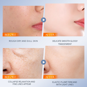 Masque Facial Hydratant et Lissant au Curcuma, Rénovateur au Collagène, Nourrissant et Éclaircissant pour la Peau du Visage, Marque Privée OEM ODM LRNAS - Product Image 6