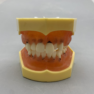 Tandheelkundig Model Voor Tandheelkundige Parodontale Pathologische Modelpraktijk Zachte Gingiva - Product Image 2