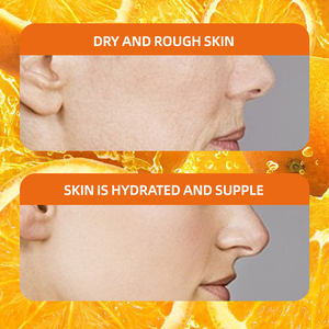Sérum à la vitamine C personnalisé pour éclaircir la peau, anti-âge, réparation de la peau, sérum à la vitamine C - Product Image 6