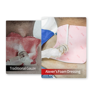Alexer dukungan medis tracheostomi, untuk cedera luka busa berdandan untuk pasien - Product Image 4