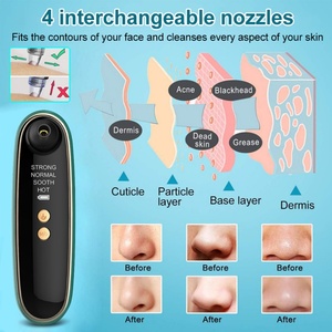 Dispositivo Visual de Succión de Puntos Negros, Dispositivo de Limpieza Facial de Poros, Eliminador Eléctrico Portátil de Puntos Negros y Eliminador de Puntos Negros con Microburbujas - Product Image 4