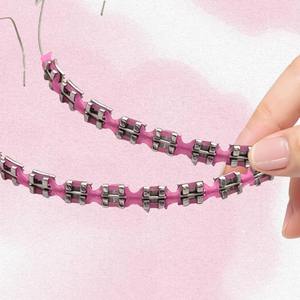 Modieuze beugels voor tanden, decoratieve beugels, orthodontische beugels, kleurrijke beugels voor volwassenen en tieners - Product Image 4