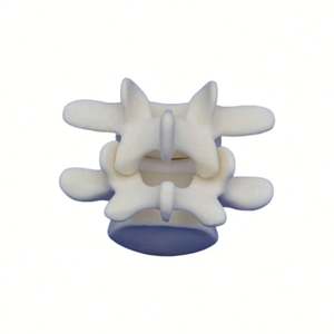 <span class=keywords><strong>Vertebra</strong></span> lombare <span class=keywords><strong>L4</strong></span> e L5 in schiuma solida KyrenMed modello osseo per la formazione in officina di ortopedia avvitamento e placcatura - Product Image 3