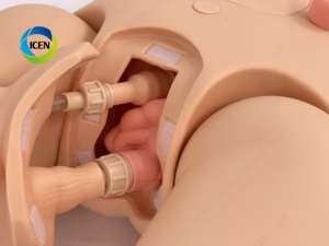 IN-M9 tiên tiến PVC con người giải phẫu hệ thống tiết niệu nam hệ thống đường tiết niệu mô hình với tuyến thượng thận niệu quản và bàng quang - Product Image 4