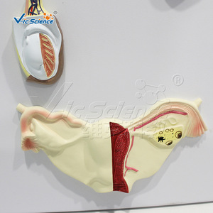 Modèle de système endocrinien de haute précision, structure combinée multi-glandulaire, équipement de formation en anatomie pour les écoles de médecine. - Product Image 4