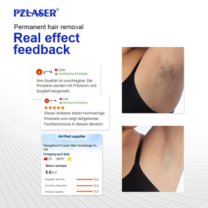 Pzlaser ไดโอดเลเซอร์808nm 3ความยาวคลื่น<span class=keywords><strong>เครื่อง</strong></span>กำจัดขนอุปกรณ์กำจัดขนเลเซอร์ - Product Image 3