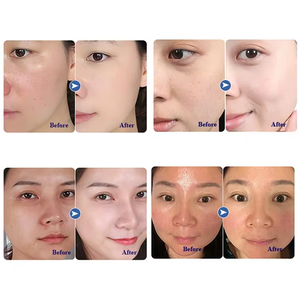 Manejado Hidratante de alta presión Watwr Oxygen Jet Peeling Facial Spa Nano Spray Maquillaje Inyector de oxígeno H - Product Image 4