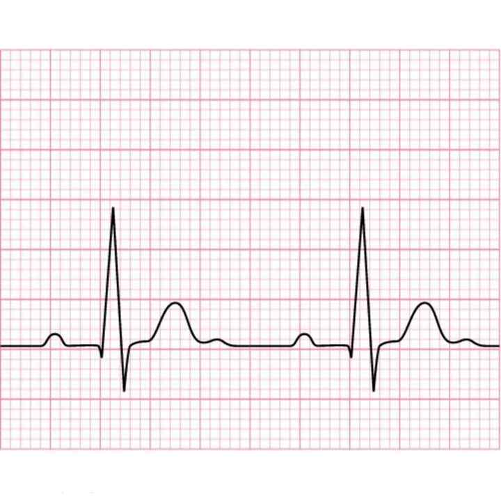 12 Channel ECG Machine Paper - FQW Medical Recording Paper