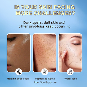 Koreaans Whitening Niacinamide Gezichts Serum met 99,9% Zuivere Essentie Poeder Ampul Verhelderende Anti-verouderings Huidverzorging Schud Voor Gebruik - Product Image 3