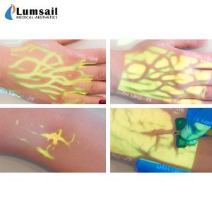 Transiluminator pencari Nadi untuk klinik hewan dan rumah sakit di kucing dan anjing hewan - Product Image 5