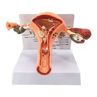 Sistema reproductivo femenino, herramienta de enseñanza de anatomía, modelo de útero humano con Vagina y ovarios, modelo de órgano de simulación patológica