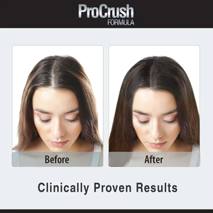 לוגו מותאם אישית לוגו, ויטמין b6 b12 ו ביוטין תוספי קפסולות שיער & ביוטין קשה קפסולה - Product Image 4