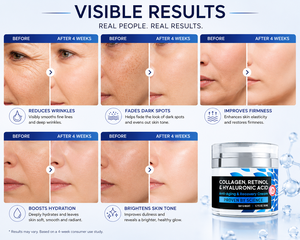 Crème <span class=keywords><strong>pour</strong></span> le <span class=keywords><strong>visage</strong></span> au collagène avec crèmes hydratantes <span class=keywords><strong>pour</strong></span> la peau <span class=keywords><strong>pour</strong></span> éliminer les taches brunes, douce <span class=keywords><strong>pour</strong></span> les peaux sensibles - Product Image 4
