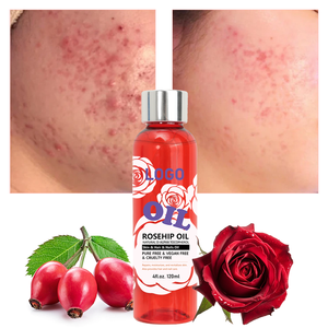 GUOCUI BIO TECHカスタムロゴAnce処理水和有機ピュアナチュラルOEM/ODMポア収縮アンチエイジングローズヒップフェイスオイル - Product Image 1