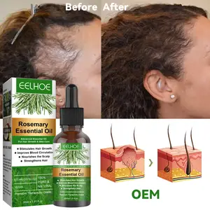 Aromlife private label natural herbal organic rosemary fast hair growth oil for african serum for black women product indian