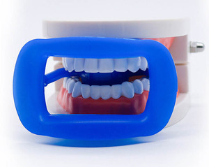 Rétracteur buccal en caoutchouc de silicone pour orthodontie, rétracteur de joue et de lèvres intra-oral, autoclave, ouvre-<span class=keywords><strong>bouche</strong></span>, blanchiment des dents, rétracteur de joue - Product Image 5