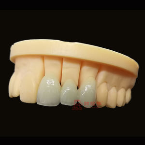 Laboratorio dentale eccellente precisione protesi fisse utilizzando materiale ceramico Zirconia porcellane tutte le corone e ponte in ceramica - Product Image 3