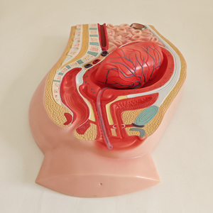 Modello Anatomico di Separazione Placentare, Modello di Anatomia Pelvica Femminile con Placenta - Product Image 1