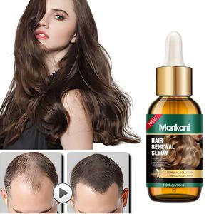 Raiz De Cabelo Forte Herbal Orgânico Atacado Scalp Elixirs Cuidados Ginseng Gengibre Anti-perda de cabelo Óleo De Crescimento De Cabelo - Product Image 1