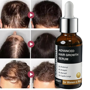 Sérum Capillaire Avancé Personnalisé de 30 ml pour la Croissance des Cheveux et du Cuir Chevelu, avec 3% Redensyl + 3% Procapil + 3% Anagain et des Ingrédients Biologiques - Product Image 1