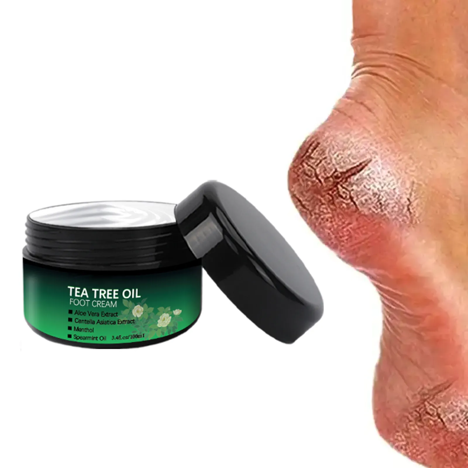 natural tea tree oil foot cream for cracked heels repair hand and foot whitening cream