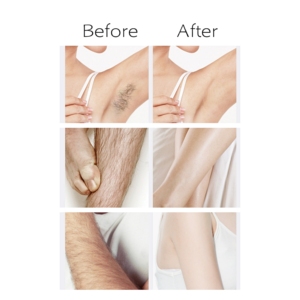 Crème dépilatoire pour <span class=keywords><strong>homme</strong></span> et femme, modèle, élimine les poils du corps, du visage, des mains, des jambes, maillot de bain - Product Image 5