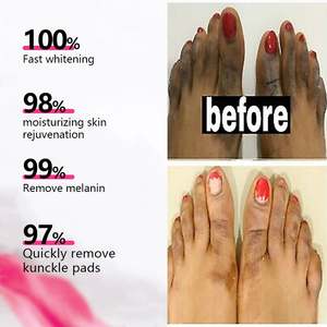 Crème hydratante blanchissante pour le corps à base de plantes en gros pour les genoux, les articulations et les coudes foncés, <span class=keywords><strong>action</strong></span> rapide, lotion blanchissante pour le corps, cosmétiques - Product Image 3