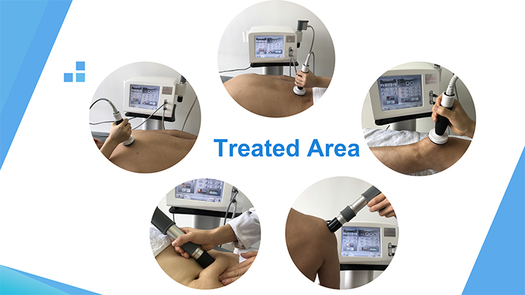 Máquina de terapia de ondas de choque balísticas neumáticas de ultrasonido para alivio del dolor