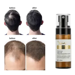 快速生长头发再生油脱发护理喷雾美容头发 & 头皮治疗男女60毫升