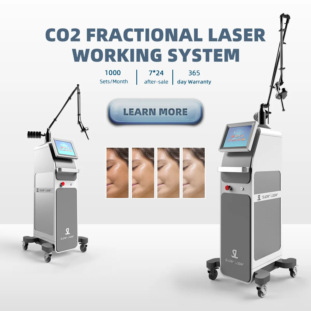 Laser frático co2, qualidade superior, cuidados com a pele e remoção de cicatriz, máquina de rejuvenescimento da pele, 10600nm, laser frático