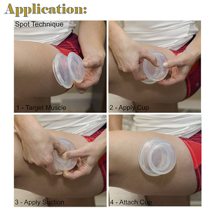 Set de Ventosas de Silicona Transparentes, Ventosas de Succión, Ventosas de Silicona para el Cuerpo, Ventosas de Hijama, Set de Terapia de Ventosas de Silicona - Product Image 4