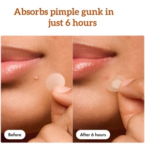 Parche hidrocoloide grande redondo <span class=keywords><strong>y</strong></span> cuadrado Parches de <span class=keywords><strong>espinillas</strong></span> <span class=keywords><strong>grandes</strong></span> Tiras hidrocoloides para cara completa Frente Barbilla Nariz - Product Image 3