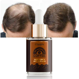 Nhãn Hiệu Riêng 100% Tự Nhiên Hữu Cơ Người Đàn Ông Phụ Nữ Chăm Sóc Da Đầu Giảm cân Sửa Chữa Mọc lại Caffeine Tăng Trưởng Tóc Dầu - Product Image 1