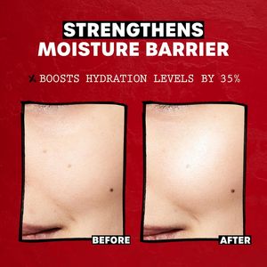 Tónico Facial Lácteo <span class=keywords><strong>THAYERS</strong></span>, Cuidado de la Piel, Hongo de Nieve, Ácido Hialurónico, Natural, Suave, Sin Fragancia, para Piel Seca y Sensible, 355 ml - Product Image 4
