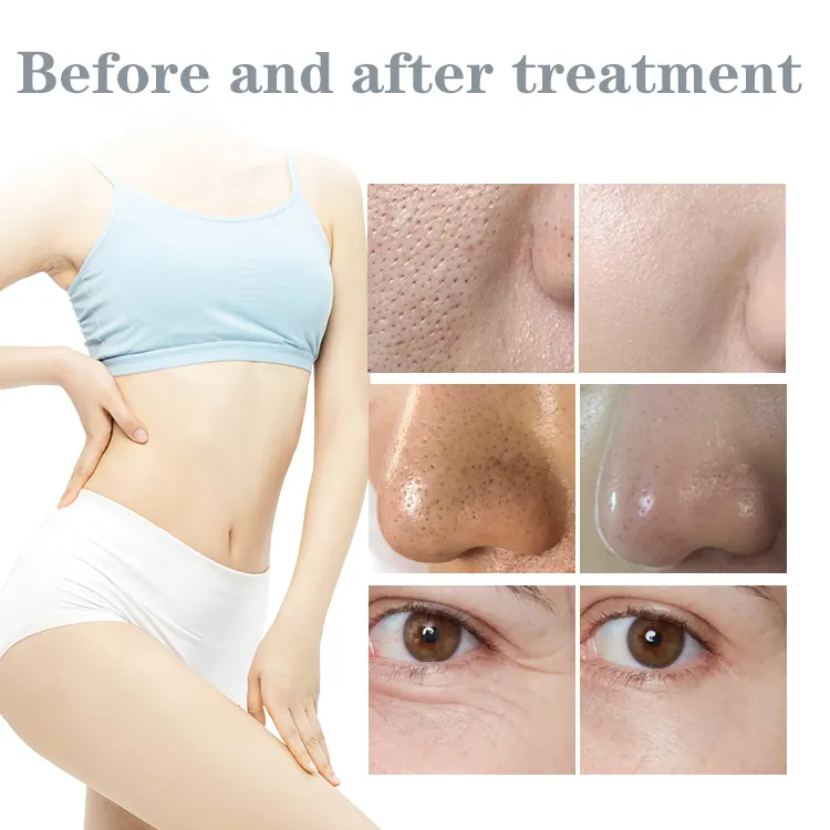 Mặt Máy chăm sóc da r 14 trong 1 Peel dermabrasion kim cương Micro dermabrasion máy để bán